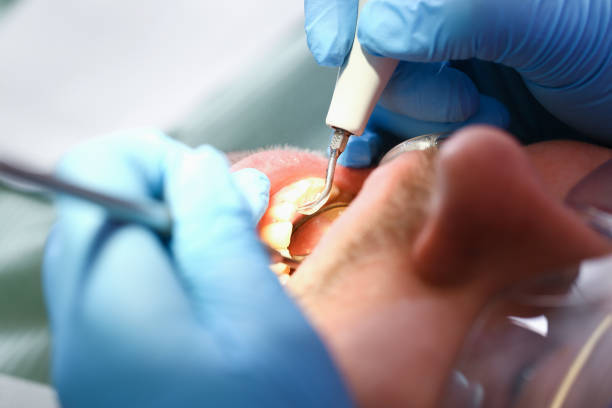 Best Chipped Tooth Repair Near Me  in Galena, KS