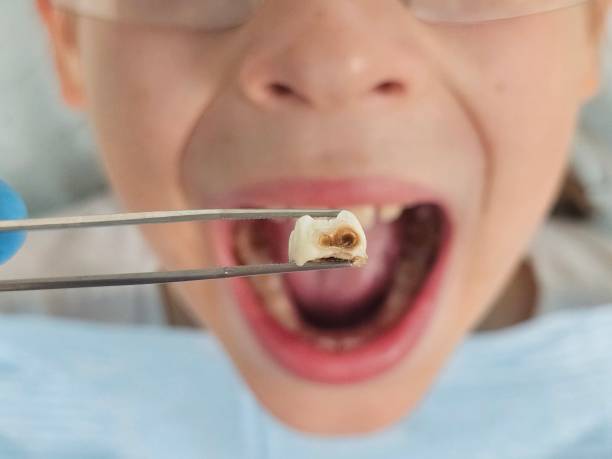 Best Tooth Pain Emergency Relief  in Galena, KS